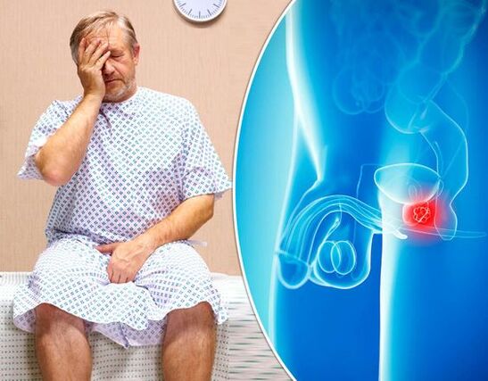 Symptomen van prostatitis