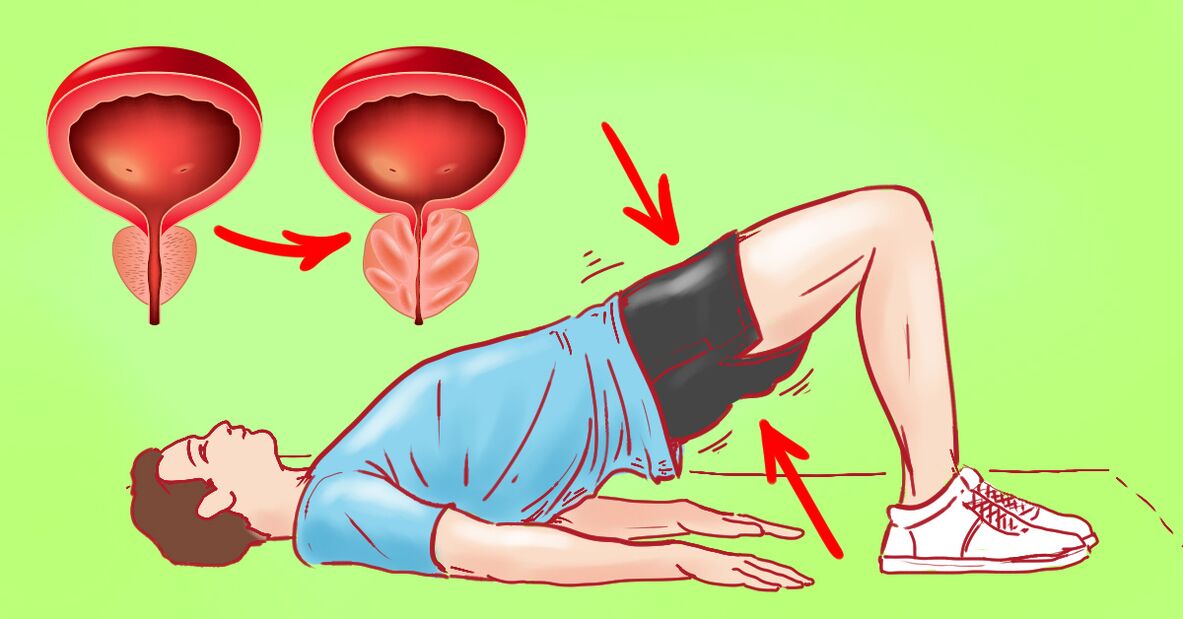 gymnastiekoefeningen voor prostatitis